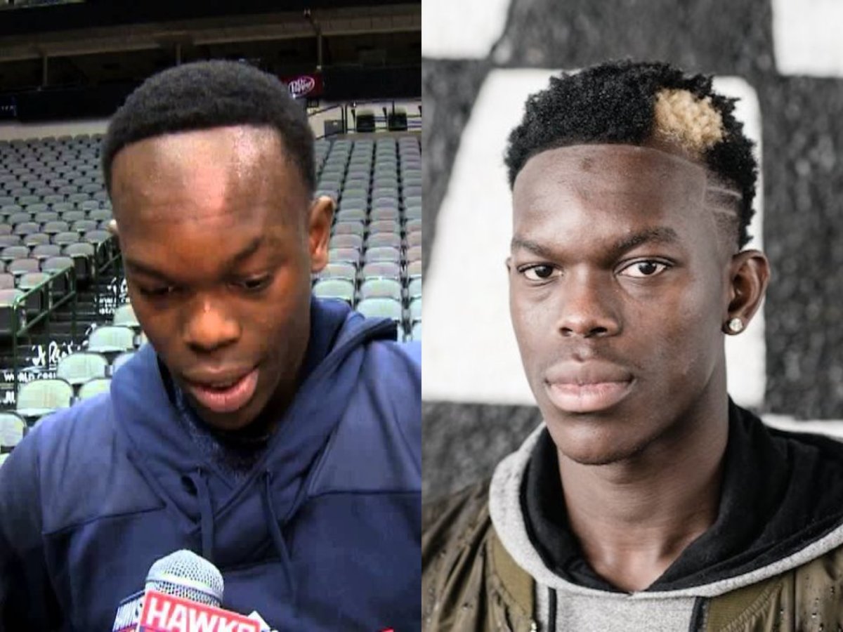 Dennis Schroder's Hairline Had A Better Comeback Than LeBron Coming Back  From 3-1 Down, Says NBA Fan - Fadeaway World