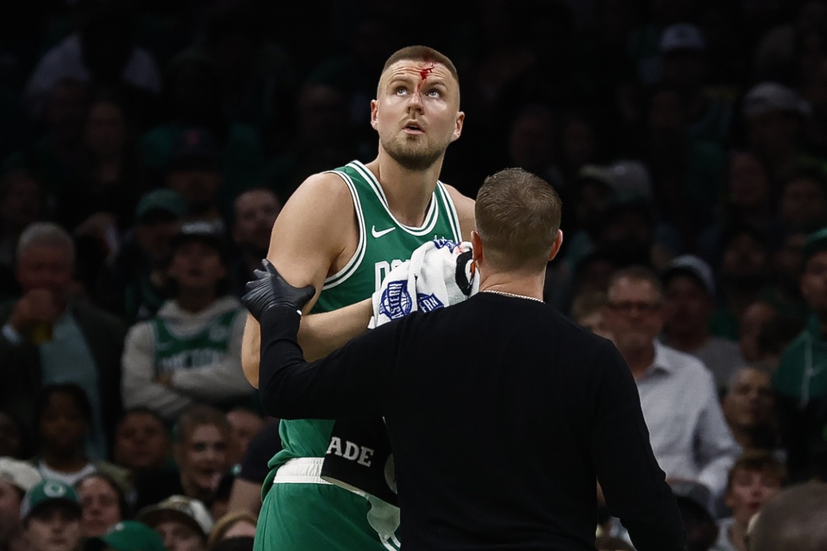 Boston Celtics center Kristaps Porzingis (8) is helped off the court after being cut by an elbow to the head against the Orlando Magic during the second half of game two of the first round of the 2024 NBA Playoffs at TD Garden. Mandatory Credit: Winslow Townson-Imagn Images